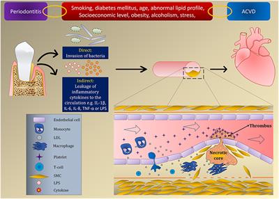 Association Between Periodontal Disease and Atherosclerotic Cardiovascular Diseases: Revisited